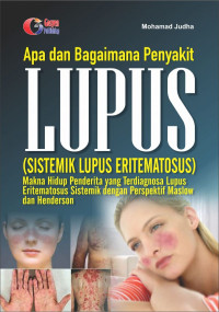 Image of Apa dan Bagaimana Penyakit Lupus ? (Sistemik Lupus Eritematosus): Makna hidup penderita yang terdiagnosa lupus eritematosus sistematik dengan perspektif maslow dan henderson